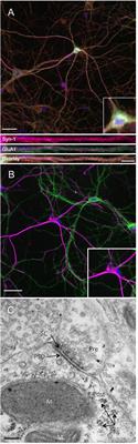 Secreted Amyloid Precursor Protein-Alpha Promotes Arc Protein Synthesis in Hippocampal Neurons